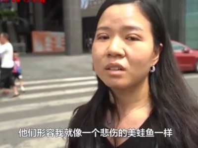 双眼皮手术变悲伤蛙？女子怒斥医美审美观，网友直呼太意外！