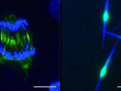 细胞分裂内部结构重组机制揭示，为治疗癌症等疾病提供新思路