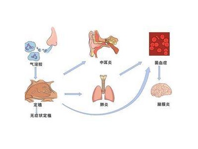 这个菌，每年有近20万儿童和老人因它而病倒｜热点关注